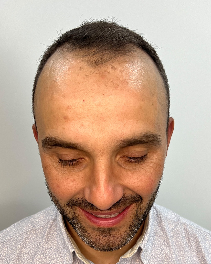 Pedro Fernandes Antes